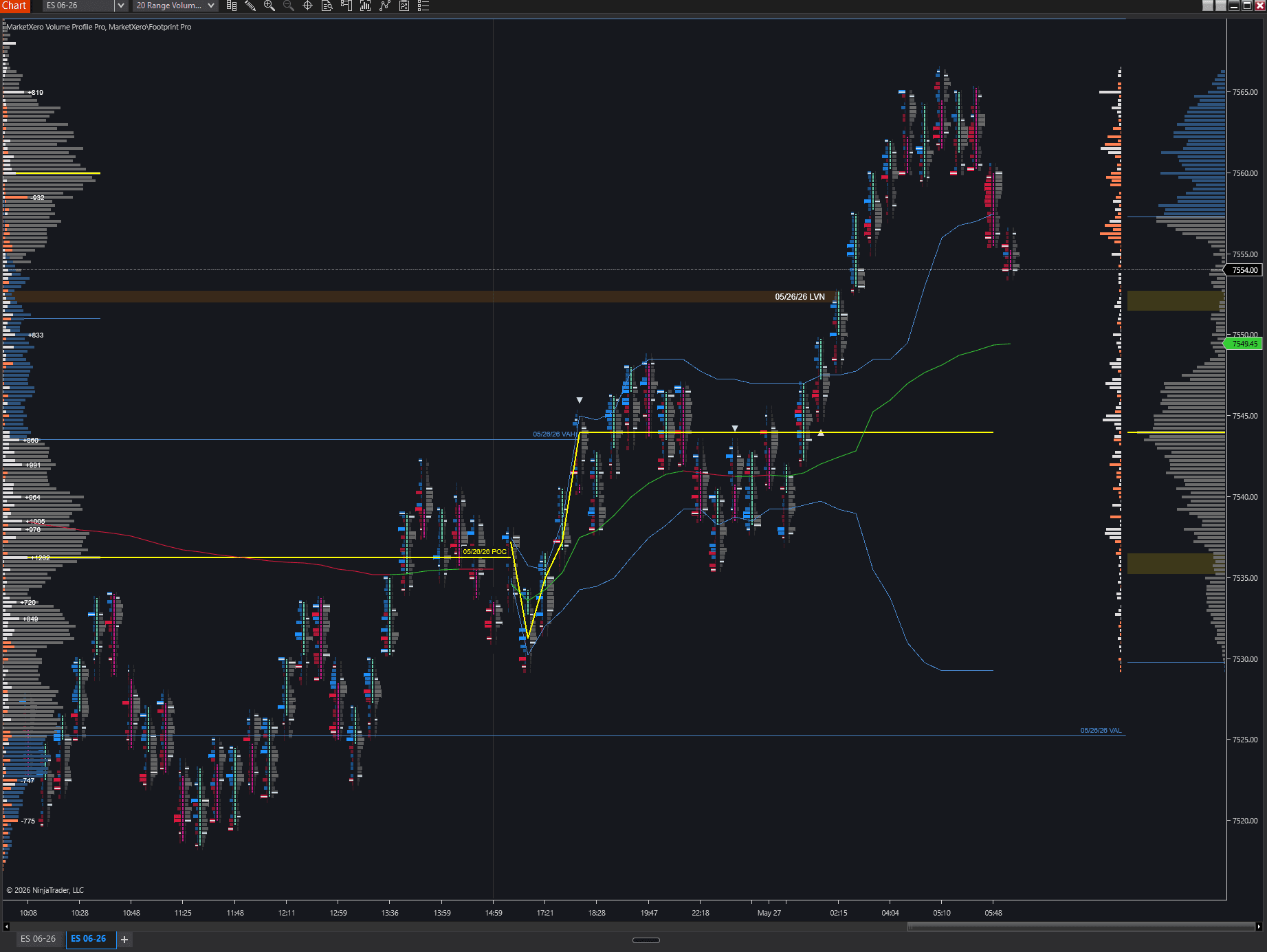 MarketXero Volume Profile showing low volume node zones and session profile context