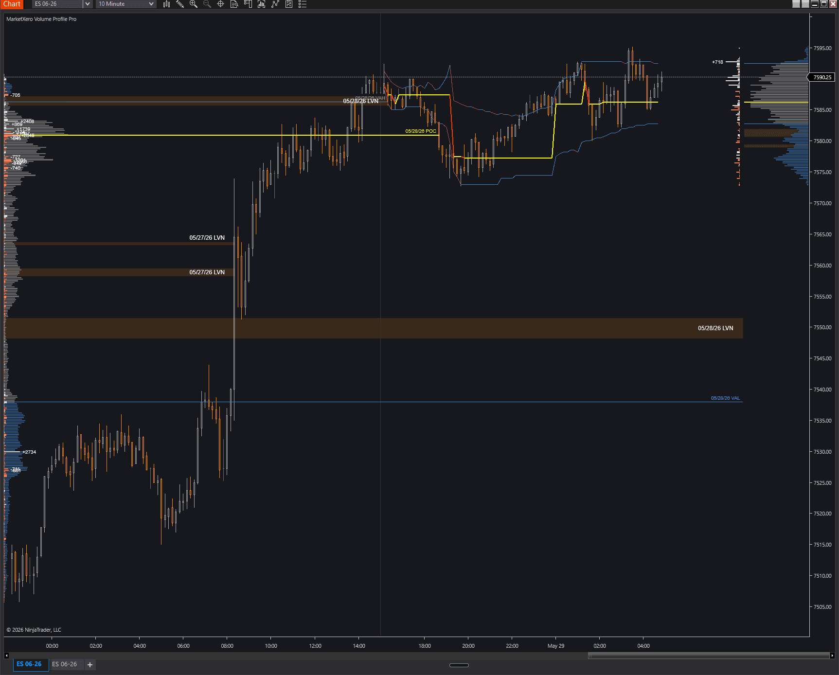 NinjaTrader chart with MarketXero Volume Profile showing POC, value area, and LVN zones